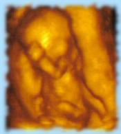 15 weeks - 3 dimensional ultra sound